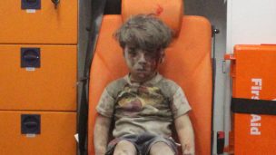 [FOTOS Y VIDEO] Así está hoy el niño símbolo de la guerra en Siria