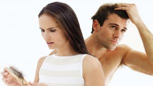 Aumento sorpresivo de la caída del pelo en mujeres: Así lo explica doctora de Medical Hair Chile