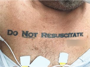 Tatuaje de un paciente provocó dilema ético en su equipo médico tratante