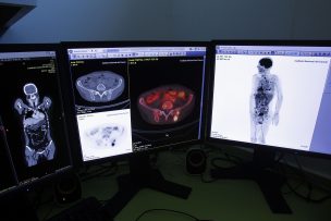 Día Mundial del Cáncer: INC estrena nuevos equipos avaluados en $6.500 millones