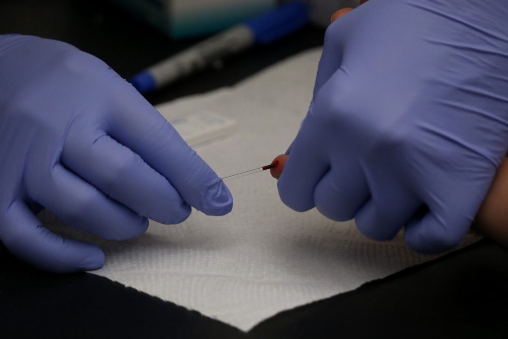 Segundo caso mundial de curación de un paciente con el virus del sida