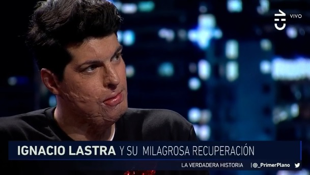Ignacio Lastra confesó el motivo de su quiebre con Julia Fernandes