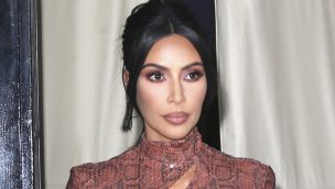 ¿Por qué Kim Kardashian no sonríe en las fotos? La modelo explicó la razón