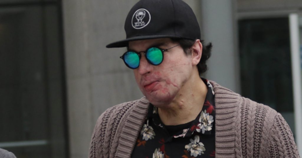 “Admiro tu valentía”: Ignacio Lastra saca aplausos con fotografía de su rostro en redes sociales