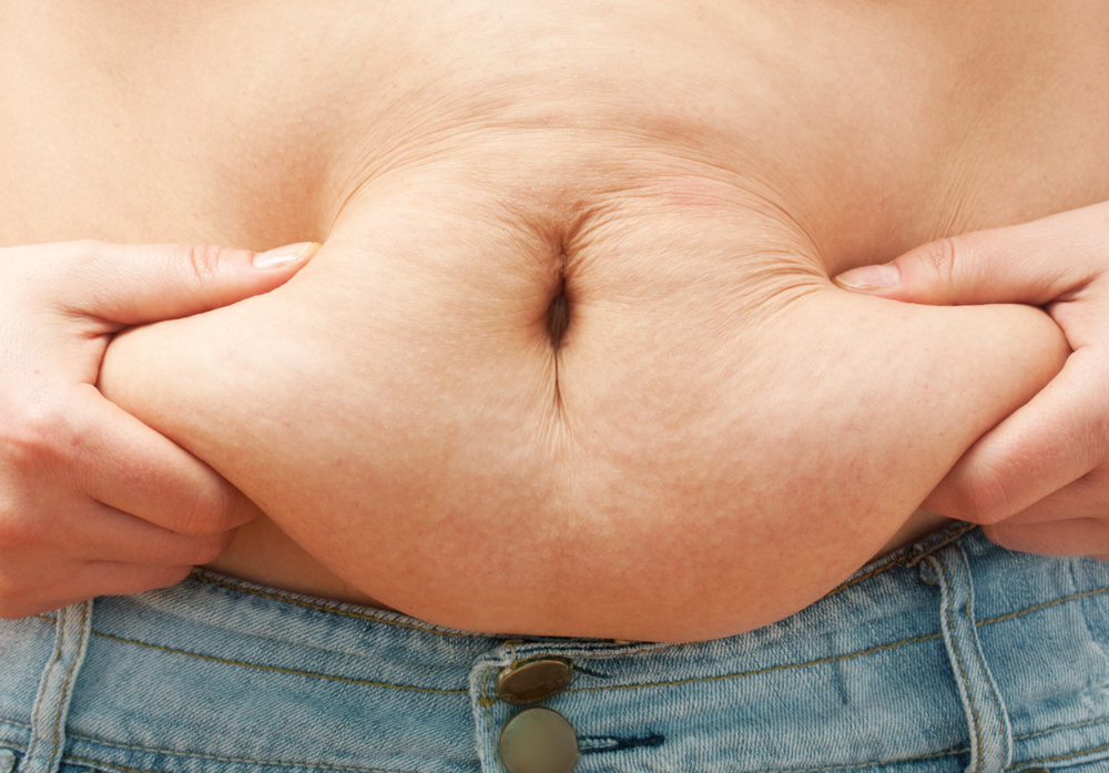 “Guatita delantal”: Hay cerca de mil cupos para abdominoplastía gratuita