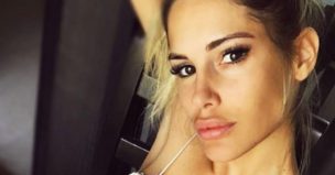 “¿Qué te pasó en los labios?”: Usuarios arremeten contra Gala Caldirola en Instagram