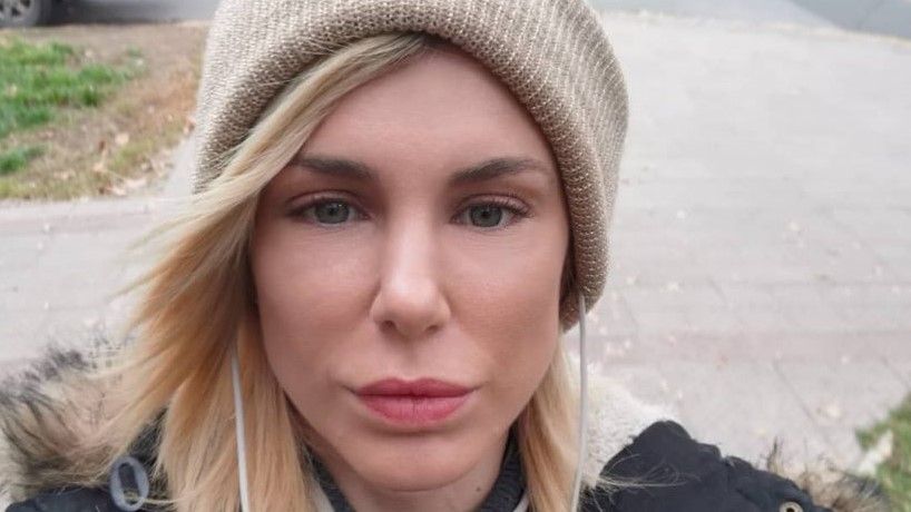 “Mi hijo lloraba por la situación”: Wilma González habló sobre las críticas que recibió luego de realizarse una rinoplastía