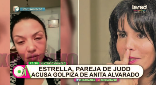Anita Alvarado fue acusada de “golpiza” por pareja de exmarido: “No le importó que el niño viera este tipo de espectáculos”