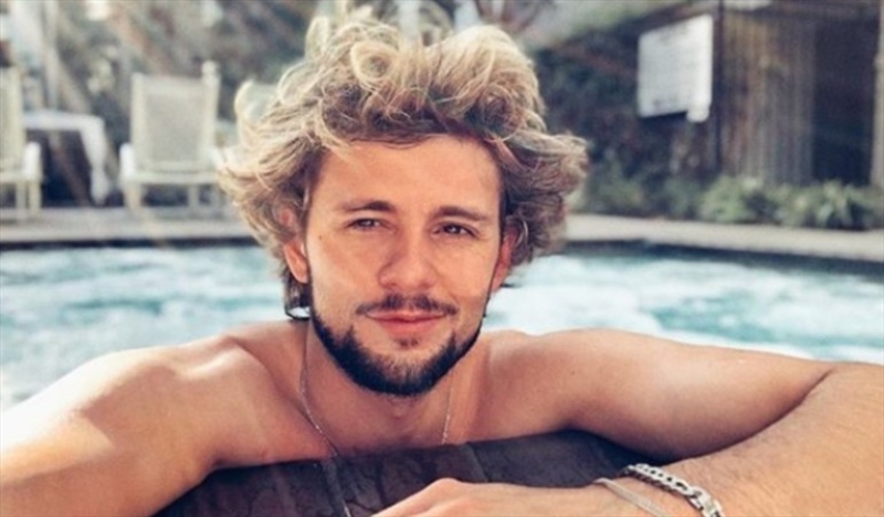 Joaquín Méndez enseñó las consecuencias de la quemadura de sol que sufrió: “Me dicen la serpiente”