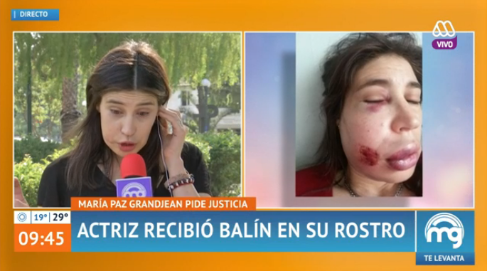 María Paz Grandjean tras sufrir impacto de balín: “Los carabineros estaban muy drogados”