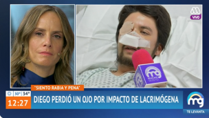 Testimonio de joven que perdió ojo por impacto de lacrimógena conmovió en 