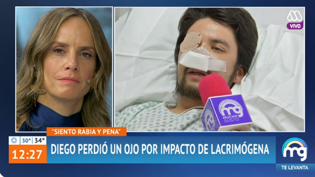 Testimonio de joven que perdió ojo por impacto de lacrimógena conmovió en “Mucho Gusto”