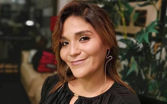 ¡Se pasó! Katherine Orellana se muestra “al natural” y envía inspirador mensaje a sus seguidores