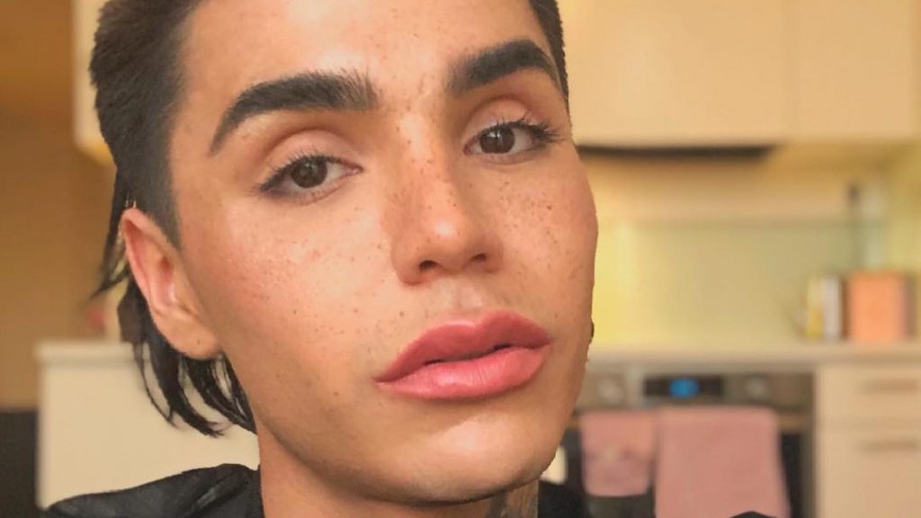 “Existe gente muy mala”: Leo Méndez Jr. mostró agresión que lo dejó con un ojo morado