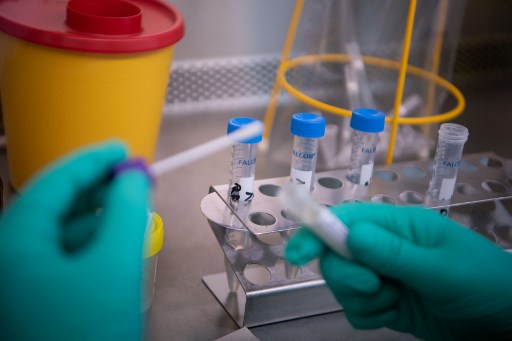 Reportan primera muerte por coronavirus fuera de China