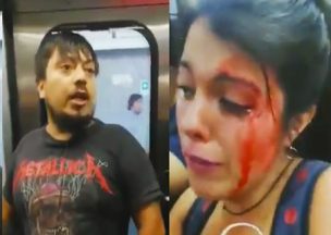 Joven que fue brutalmente atacada en el Metro: 