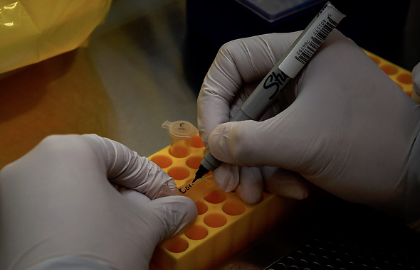 Austria vuelve a moverse en cifras récord de contagios diarios de Covid-19