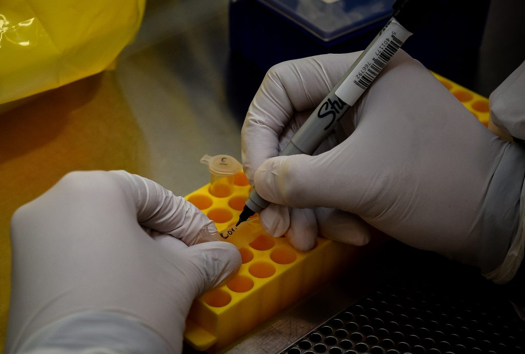 Estados Unidos le da la venia a la segunda fase de la vacuna contra el coronavirus