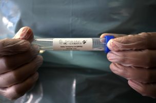 Expertos aseguran que el coronavirus puede desencadenar diabetes en personas sanas