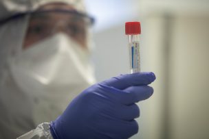 Fallecidos por coronavirus ya superan las 400 mil personas en el mundo