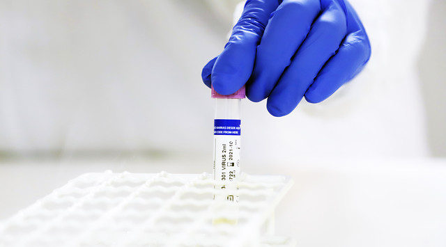 Coronavirus supera 12 millones de casos en todo el mundo y 550.000 fallecidos