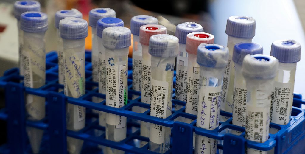 Covid-19: Más de 21 millones de contagios en el mundo