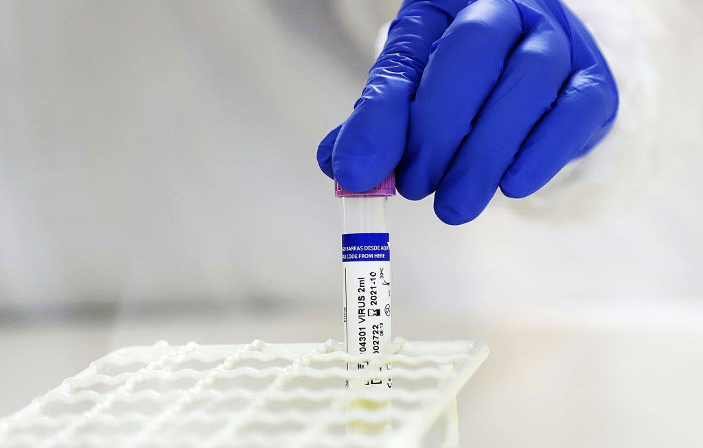Rusia anuncia que ya produjo la primera partida de su vacuna contra el COVID-19 en medio de dudas por su efectividad