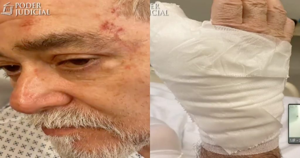 Desclasifican fotografías de Hernán Calderón herido en Control de Detención de “Nano” Calderón