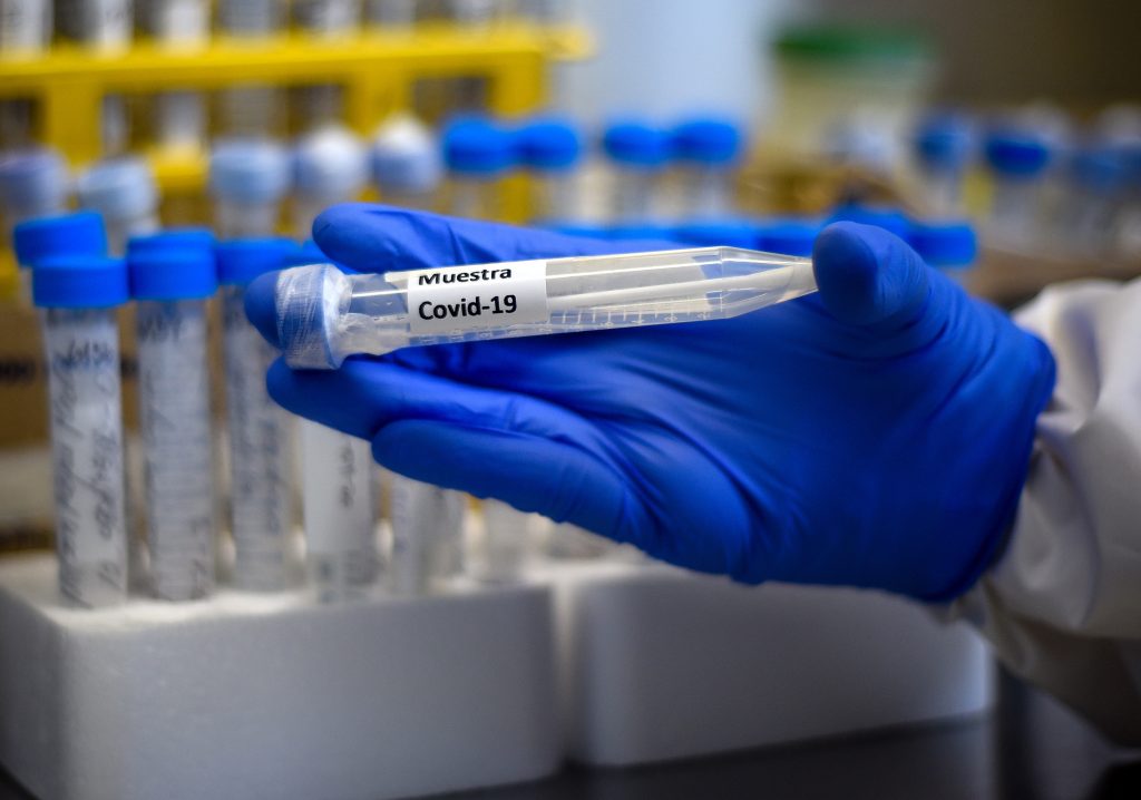 Informe Epidemiológico: DEIS registró 20.439 muertes asociadas al COVID-19 y Punta Arenas lidera casos activos