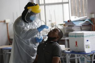 El mundo alcanza los 34,9 millones de contagios por coronavirus