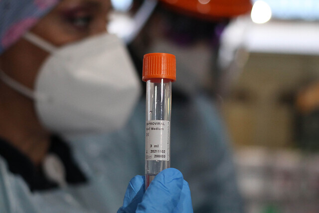 De Pandemia a Endemia: Ministro Paris explica el concepto que rige en Chile sobre el Covid-19