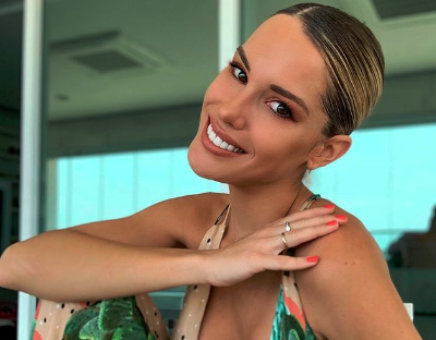 “Tanta lipo no te sienta bien querida”: Gala Caldirola recibió duros comentarios por fotografía en Brasil