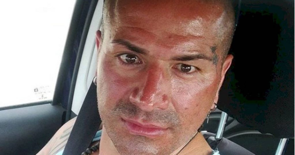 La transformación de Kike Acuña tras aplicarse botox en el rostro: “Me dicen que me veo más bonito”