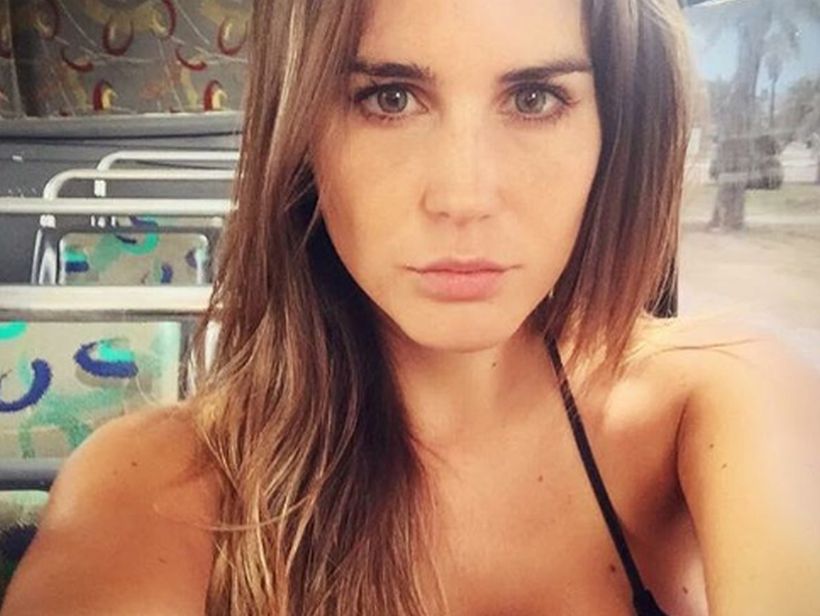 “¡Qué le pasó a tu nariz!”: Fran Undurraga recibió ácidos comentarios por nueva fotografía