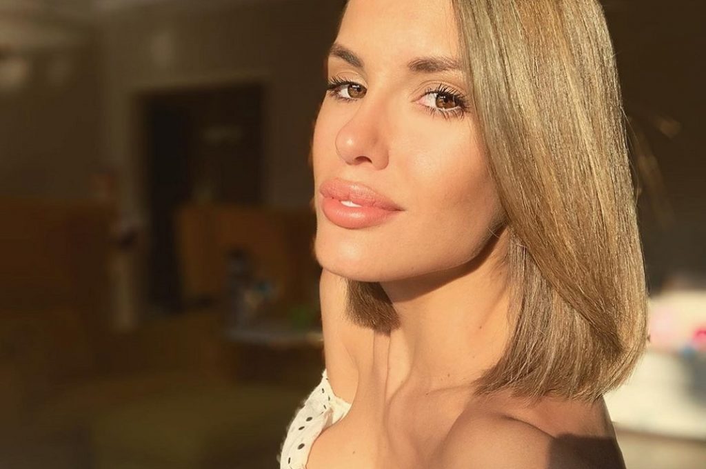 ¿Lo notas? Gala Caldirola se sometió a nuevo procedimiento estético: se inyectó “bótox preventivo”