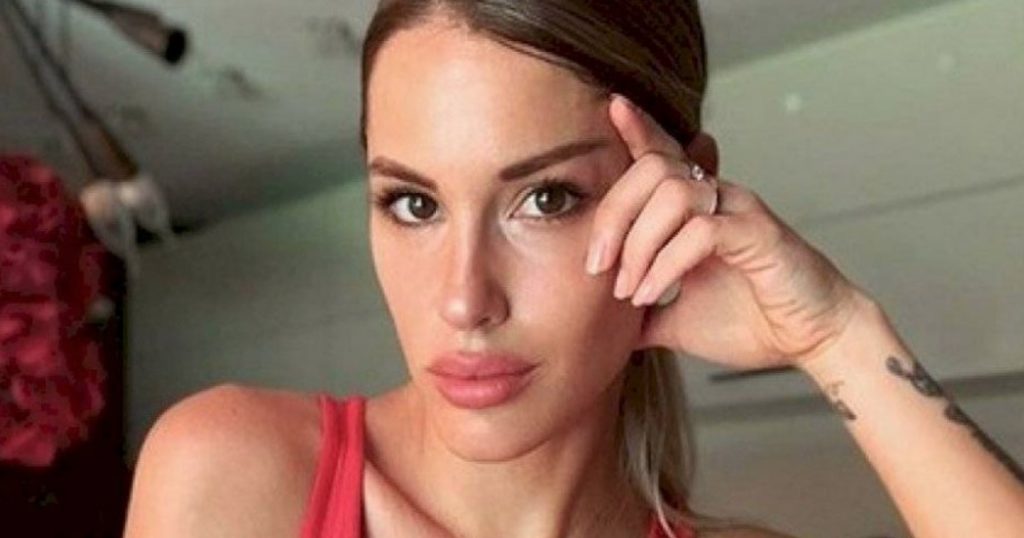 Gala Caldirola explicó por qué tiene sus labios “moreteados”: sería por tratamiento estético
