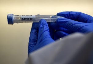 Pandemia de coronavirus llega a los 75,7 millones de contagios globales