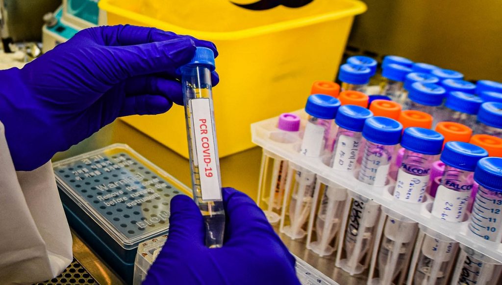 Región del Biobío registró 102 casos nuevos de coronavirus