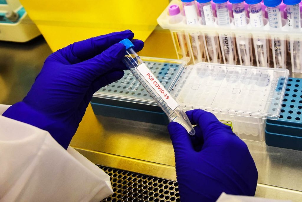 Región del Biobío presenta 398 casos nuevos, 41.168 acumulados y 2.359 activos de Covid-19
