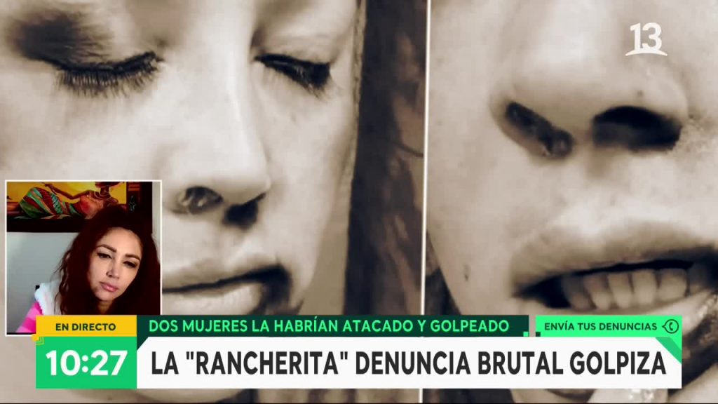 “La Rancherita” entregó detalles de violenta agresión que sufrió: “Me tiré al suelo para que no me siguieran pegando”