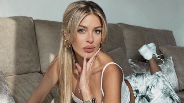 “Pelo sucio y sin extensiones”: Oriana Marzoli reveló cómo se ve su cabellera antes de someterse a tratamientos capilares 