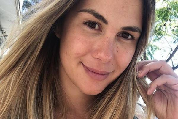 Laura Prieto reveló que sometió su rostro a “incómodo” procedimiento estético