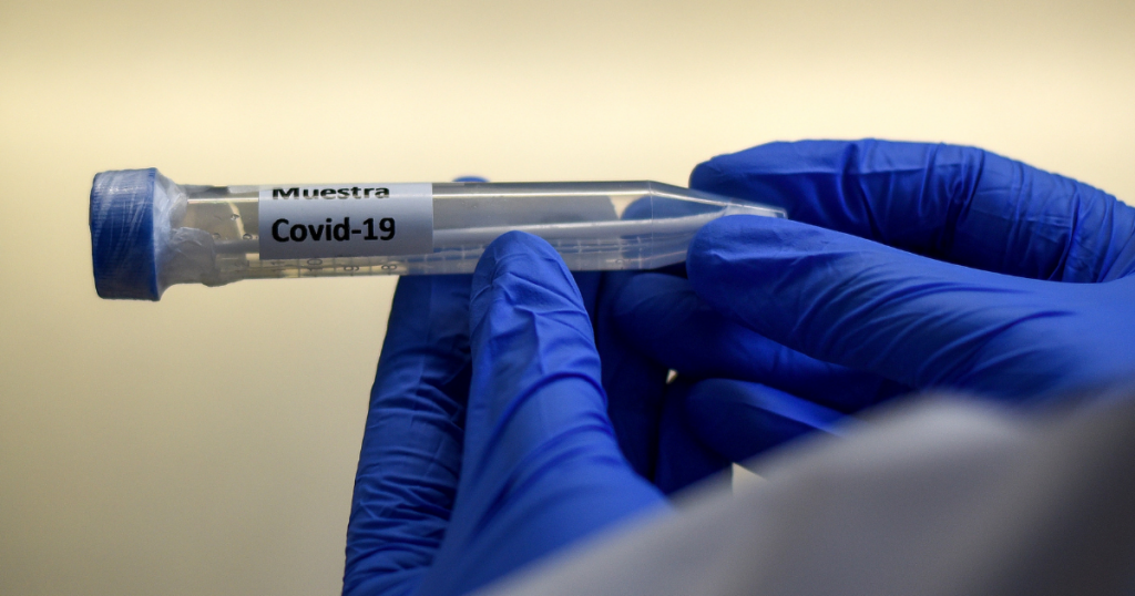 Italia registra el mayor número de contagios de Covid-19 de toda la pandemia