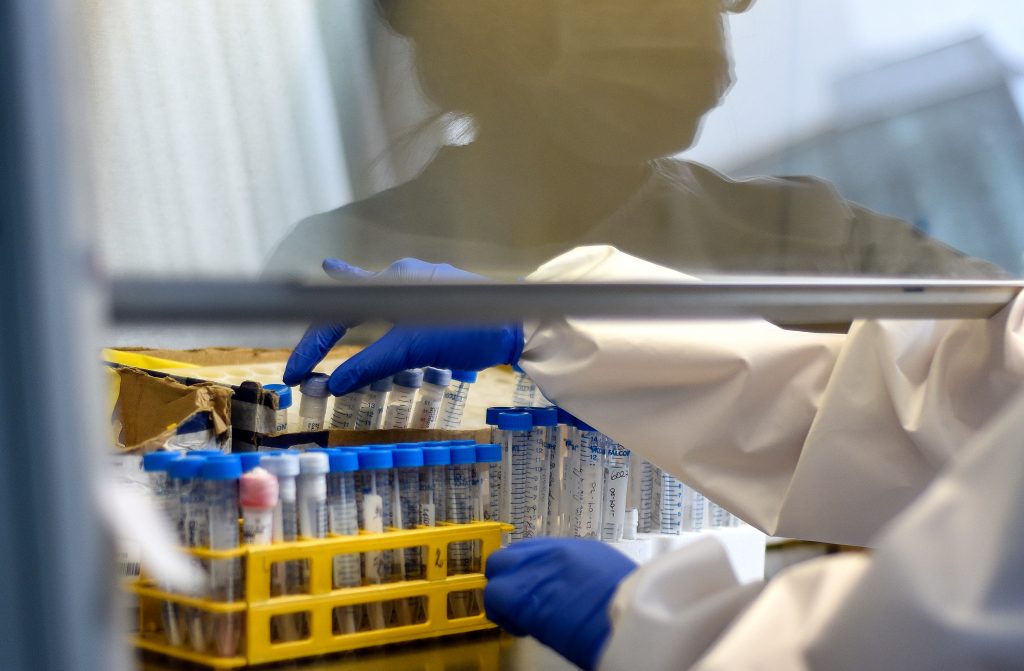 Detectan el primer caso de “flurona”, infección simultánea de coronavirus y gripe