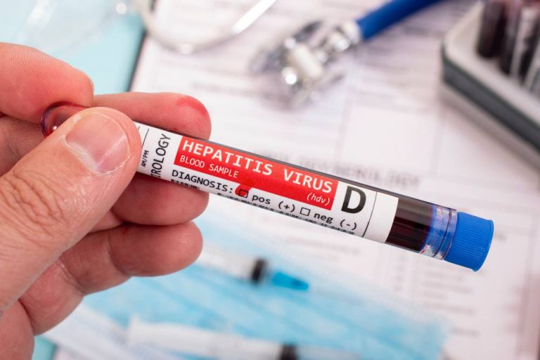 Sistema frontal aumenta el riesgo de hepatitis A: conoce las recomendaciones para evitar el contagio