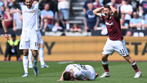 Conmoción en la Premier League por la terrible lesión de un futbolista del Burnley