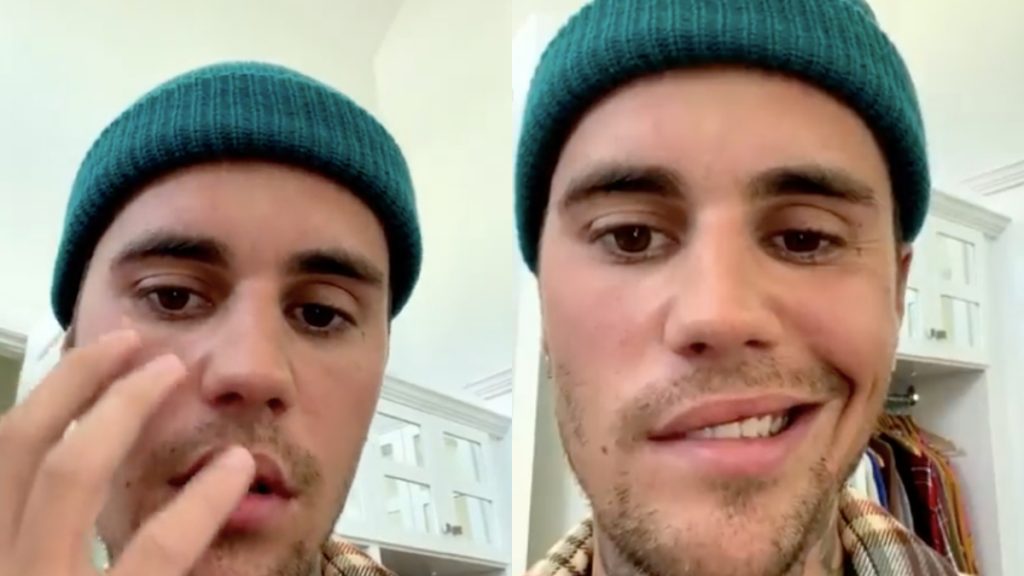 “Recen por mí”: Justin Bieber anuncia la cancelación de sus conciertos por síndrome que paralizó la mitad de su rostro