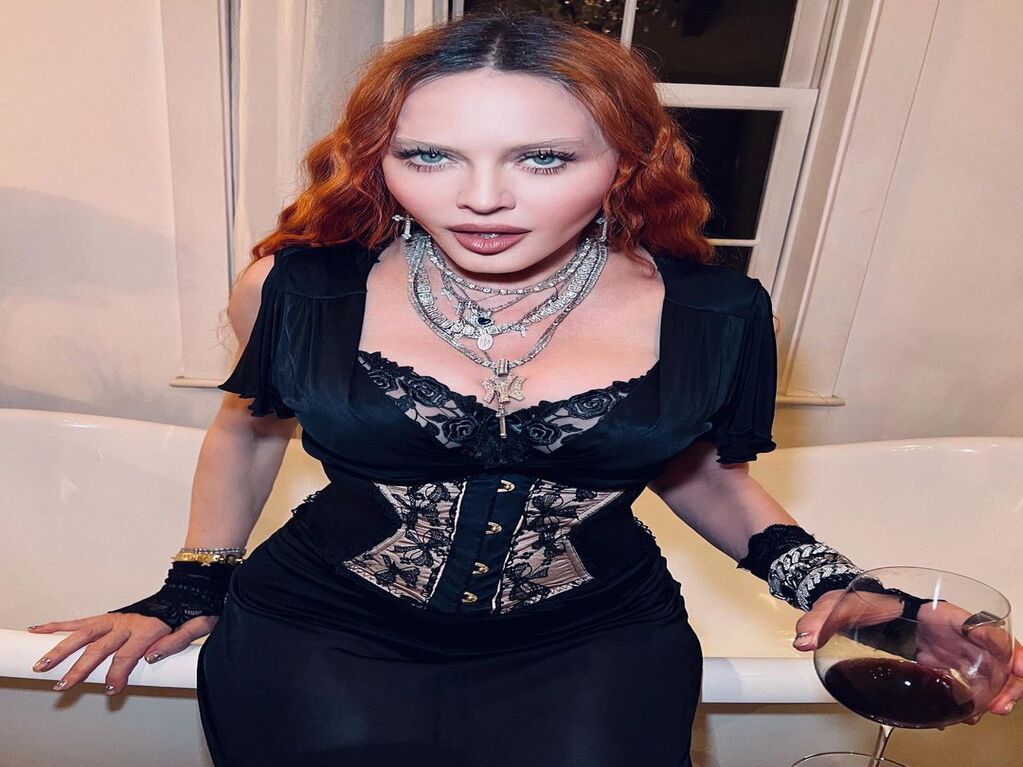 “No luces bien”: Madonna se llenó de críticas por su retocado rostro