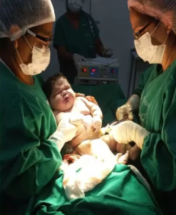 Mujer da a luz a “bebé gigante” en Brasil: Pesó más de 7 kilos y midió casi 60 centímetros