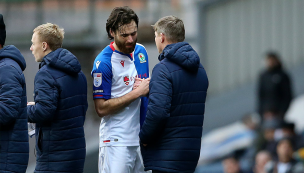 DT de Blackburn Rovers y problemas físicos de Ben Brereton: “Está muy en duda”